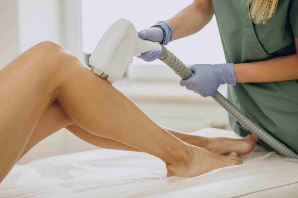 Depilacion laser